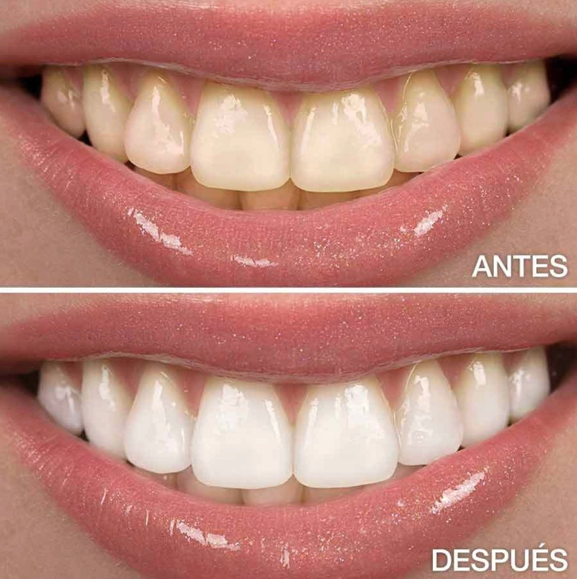 V34® Blanqueador